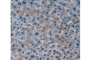 Used in DAB staining on fromalin fixed paraffin-embedded Liver tissue (ITFG1 抗体  (AA 55-306))