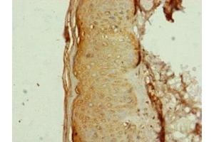 Immunohistochemistry (IHC) image for anti-Adaptor-Related Protein Complex 1, mu 1 Subunit (AP1M1) (AA 1-160) antibody (ABIN7144350)