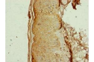 Immunohistochemistry of paraffin-embedded human skin tissue using ABIN7144350 at dilution of 1:100 (AP1M1 抗体  (AA 1-160))