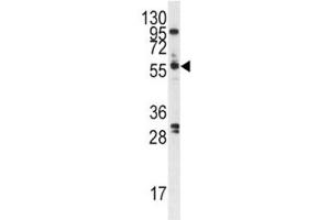 Western blot analysis of PLK antibody and A375 cell lysate. (PLK1 抗体  (AA 573-603))