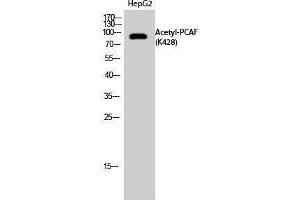 Western Blotting (WB) image for anti-K(lysine) Acetyltransferase 2B (KAT2B) (acLys428) antibody (ABIN3179010) (KAT2B 抗体  (acLys428))