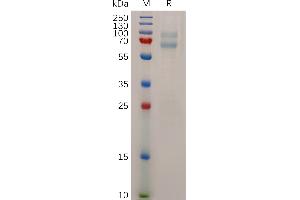Human MA Protein, His Tag on SDS-PAGE under reducing condition.