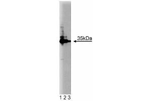 Western blot analysis of HAX-1 on Jurkat cell lysate. (HAX1 抗体  (AA 10-148))