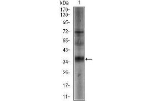 Western blot analysis using SRY mouse mAb against NTERA-2 (1) cell lysate. (SRY 抗体  (AA 1-204))