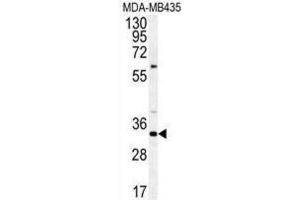 Western Blotting (WB) image for anti-Coiled-Coil Domain Containing 101 (CCDC101) antibody (ABIN3002249)