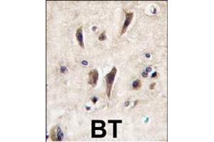 Immunohistochemistry (Paraffin-embedded Sections) (IHC (p)) image for anti-tyrosine Kinase with Immunoglobulin-Like and EGF-Like Domains 1 (TIE1) (AA 12-42), (N-Term) antibody (ABIN392060)
