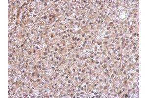 IHC-P Image Immunohistochemical analysis of paraffin-embedded HBL435 xenograft, using TrxR1, antibody at 1:500 dilution. (TXNRD1 抗体)