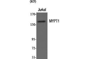 Western Blotting (WB) image for anti-Myosin Phosphatase, Target Subunit 1 (PPP1R12A) (Thr696) antibody (ABIN5957178)
