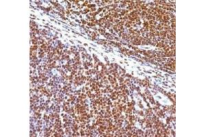 IHC staining of human tonsil with SUMO1 antibody (clone S1MT-2). (SUMO1 抗体)