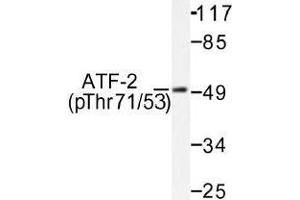 Image no. 1 for anti-Activating Transcription Factor 2 (ATF2) (pThr53), (pThr71) antibody (ABIN317966) (ATF2 抗体  (pThr53, pThr71))