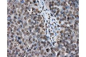 Immunohistochemical staining of paraffin-embedded colon tissue using anti-DAPK2 mouse monoclonal antibody. (DAPK2 抗体)