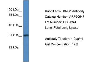 WB Suggested Anti-TBRG1  Antibody Titration: 0. (TBRG1 抗体  (N-Term))