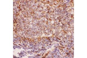 Anti-CD11b Picoband antibody ,  IHC(P): Rat Spleen Tissue