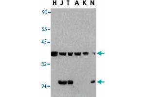 Western blot analysis of CFLAR in total cell lysates from HeLa (H), Jurkat (J), THP-1 (T), A-431 (A), K-562 (K) and NIH3T3 (N) cells with CFLAR polyclonal antibody  at 1 : 1000 dilution. (FLIP 抗体  (AA 191-209))