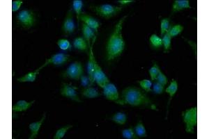 Immunofluorescence staining of U251 cells with ABIN7146257 at 1:200, counter-stained with DAPI. (CALB1 抗体  (AA 2-261))