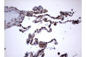Image no. 2 for anti-Tumor Necrosis Factor Receptor Superfamily, Member 8 (TNFRSF8) (AA 19-379) antibody (ABIN1491086) (TNFRSF8 抗体  (AA 19-379))