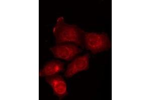 ABIN6275881 staining HepG2 by IF/ICC. (ATG16L2 抗体  (Internal Region))