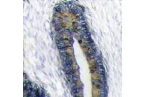Image no. 2 for anti-Finkel-Biskis-Reilly Murine Sarcoma Virus (FBR-MuSV) Ubiquitously Expressed (FAU) (Center) antibody (ABIN357137) (FAU 抗体  (Center))