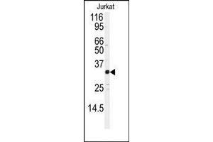 Western blot analysis of anti-JUND Antibody in Jurkat cell line lysates (35ug/lane). (JunD 抗体  (Ser2655))