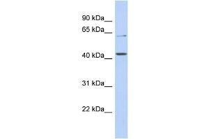 Western Blotting (WB) image for anti-Solute Carrier Family 22 (Organic Anion/urate Transporter), Member 12 (SLC22A12) (N-Term) antibody (ABIN2781716)
