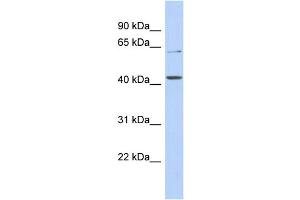 WB Suggested Anti-SLC22A12 Antibody Titration:  0. (SLC22A12 抗体  (N-Term))