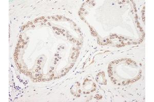 anti-RAD50 Homolog (S. Cerevisiae) (RAD50) (AA 700-750) antibody