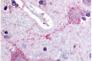 Human Brain, Cortex (formalin-fixed, paraffin-embedded) stained with PCSK6 antibody ABIN213558 at 20 ug/ml followed by biotinylated goat anti-rabbit IgG secondary antibody ABIN481713, alkaline phosphatase-streptavidin and chromogen. (PCSK6 抗体  (Internal Region))