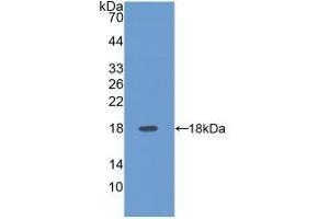 Detection of Recombinant SELE, Human using Polyclonal Antibody to E-selectin (Selectin E/CD62e 抗体  (AA 108-238))