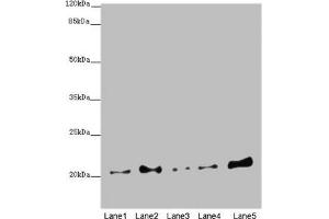 Western blot All lanes: COMMD1 antibody at 5. (COMMD1 抗体  (AA 1-190))