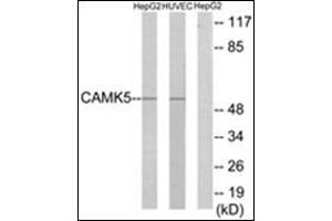 Western blot analysis of extracts from HepG2/HuvEc cells, using CAMK5 Antibody. (CAMKV 抗体)