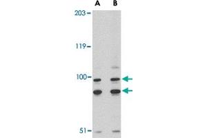 Western blot analysis of SATB1 in A-20 cell lysate with SATB1 polyclonal antibody  at (A) 2 and (B) 4 ug/mL . (SATB1 抗体  (C-Term))