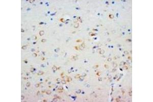 Immunohistochemical analysis of paraffin embedded rat tissue sections (brain), staining SHH in cytoplasm, DAB chromogenic reaction (Sonic Hedgehog 抗体  (N-Term))