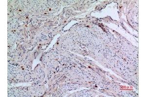 Immunohistochemistry (IHC) analysis of paraffin-embedded Human uterus, antibody was diluted at 1:100.