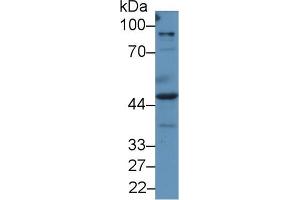 Western blot analysis of Human A549 cell lysate, using Human PRAME Antibody (2 µg/ml) and HRP-conjugated Goat Anti-Rabbit antibody ( (PRAME 抗体  (AA 416-502))