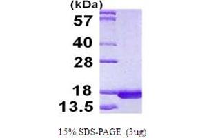 SDS-PAGE (SDS) image for Ribosomal Protein, Large, P2 (RPLP2) (AA 1-115) protein (His tag) (ABIN667670)