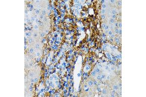 Immunohistochemistry of paraffin-embedded human liver using Collagen VI/COL6 Rabbit mAb (ABIN7266462) at dilution of 1:100 (40x lens). (COL6A1 抗体)