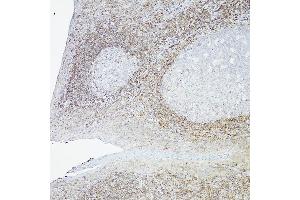 Immunohistochemistry of paraffin-embedded Human tonsil(100X) using Bcl-2 antibody (ABIN7265810) at dilution of 1:100 (40x lens). (Bcl-2 抗体)