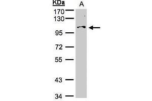 WB Image Sample (30μg whole cell lysate) A:Hep G2 , 7. (NCKAP1 抗体)