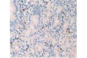 IHC-P analysis of Human Stomach Tissue, with DAB staining. (Amylin/DAP 抗体)