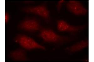 Image no. 1 for anti-Cyclin-Dependent Kinase 6 (CDK6) (pTyr24) antibody (ABIN319290) (CDK6 抗体  (pTyr24))