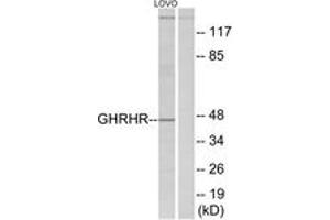 Western blot analysis of extracts from LOVO cells, using GHRHR Antibody. (GHRHR 抗体  (AA 351-400))