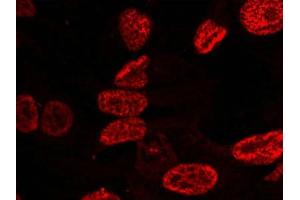 Immunofluorescence (IF) image for anti-Tumor Protein P53 (TP53) (pSer15) antibody (ABIN7138434)