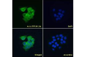 ABIN6391349 Immunofluorescence analysis of paraformaldehyde fixed A431 cells, permeabilized with 0. (PPP1R12A 抗体  (C-Term))