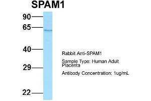 Host: Rabbit Target Name: SPAM1 Sample Type: Human Adult Placenta Antibody Dilution: 1. (SPAM1 抗体  (C-Term))