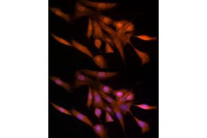Immunofluorescence analysis of NIH/3T3 cells using Ube2L3 / UBCH7 Rabbit mAb (ABIN7271178) at dilution of 1:25 (40x lens). (UBE2L3 抗体)