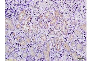 Immunohistochemistry (Paraffin-embedded Sections) (IHC (p)) image for anti-Metastasis Associated in Colon Cancer 1 (MACC1) (AA 761-852) antibody (ABIN706526)