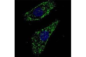 Fluorescent image of U251 cells stained with LAMP1 antibody at 1:200. (LAMP1 抗体  (AA 125-154))