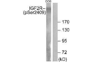 Immunohistochemistry analysis of paraffin-embedded human brain tissue using IGF2R (Phospho-Ser2409) antibody. (IGF2R 抗体  (pSer2409))