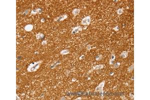 Immunohistochemistry of Human brain  using SLC25A13 Polyclonal Antibody at dilution of 1:35 (slc25a13 抗体)