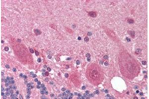 Human Brain, Cerebellum (formalin-fixed, paraffin-embedded) stained with OPTN antibody ABIN214196 at 10 ug/ml followed by biotinylated goat anti-rabbit IgG secondary antibody ABIN481713, alkaline phosphatase-streptavidin and chromogen. (OPTN 抗体  (AA 575-591))